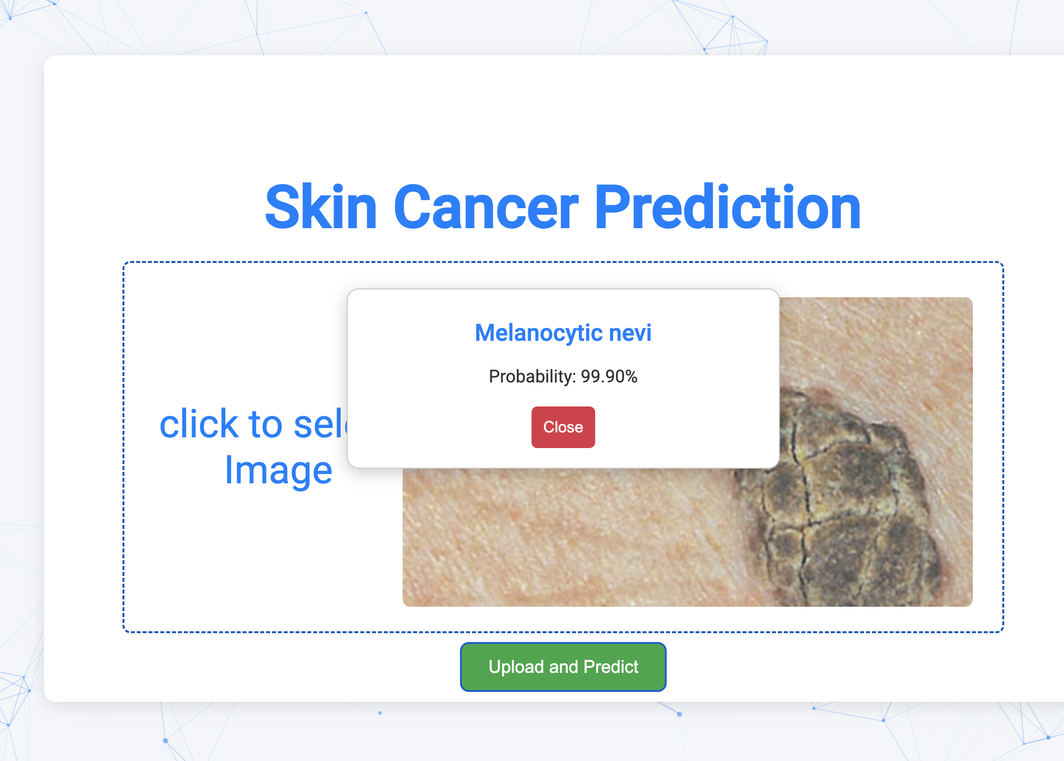 Skin Cancer Type Prediction System